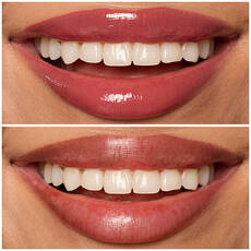 Labios de modelo usando Lip I.V. 08 Drippin' in Rose.