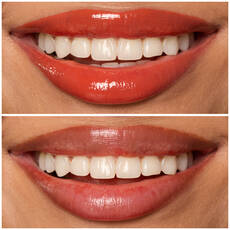 Labios de modelo usando Lip I.V. 12 Burst That Tang.
