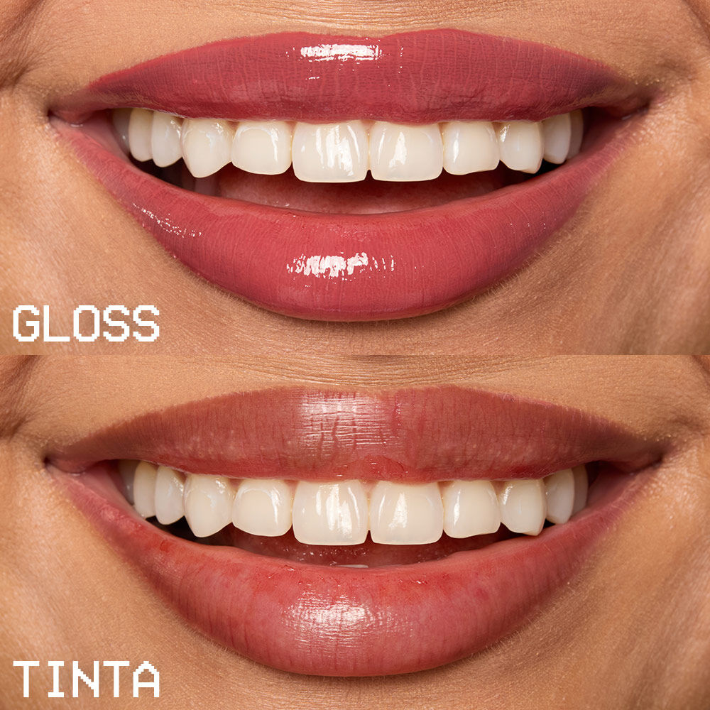 LIP IV
